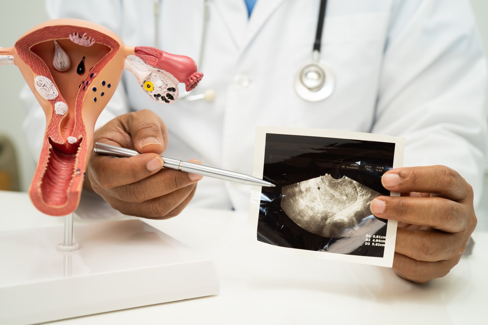 Endometrium Kanseri Nasıl Teşhis Edilir? Tanı Sürecinde Hangi Tetkikler Yapılır?