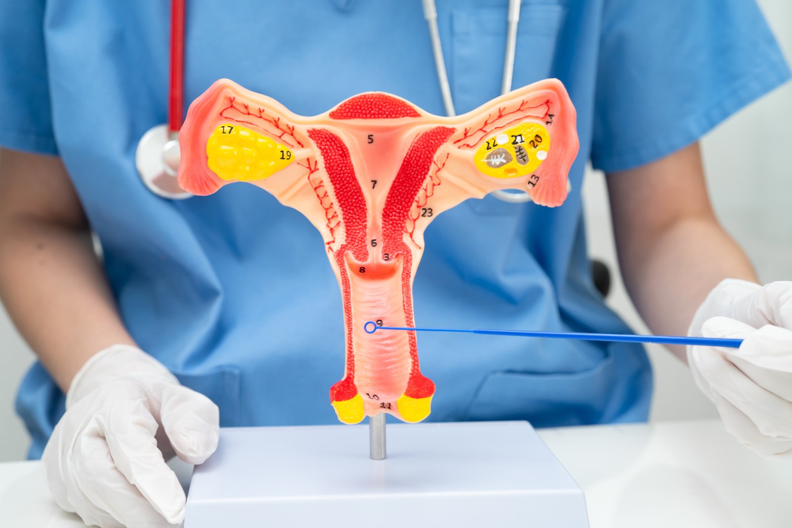 Endometrium Kalınlaşması (Endometrial Hiperplazi) Nedir? Her Kalınlaşma Kanser Anlamına Gelir mi?